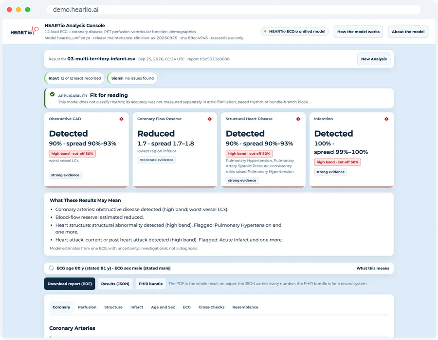 The browser console: the four headline calls for the sample record.
