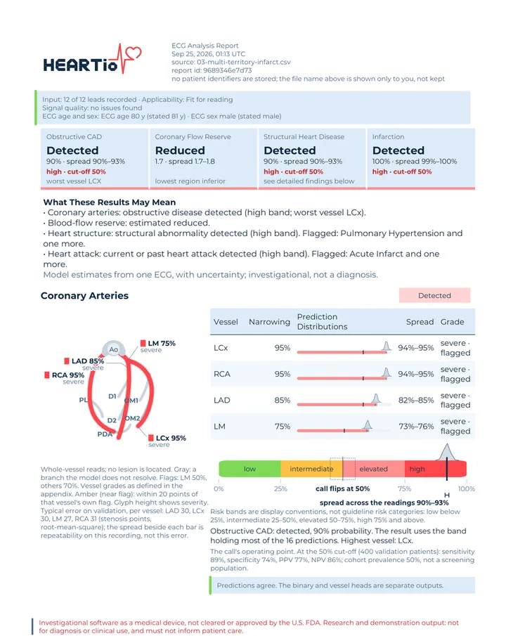 Page one of the PDF report for the sample record.